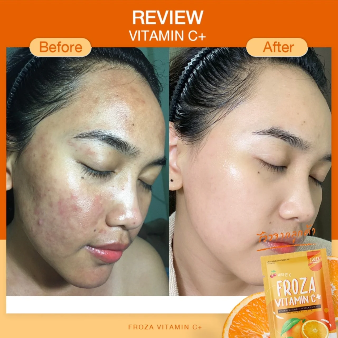 Froza Vitamin C+ – Image 2